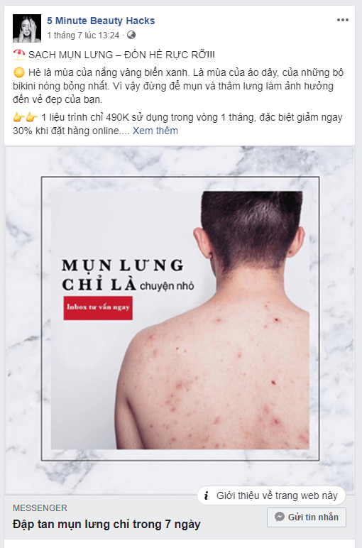 Trị mụn lưng